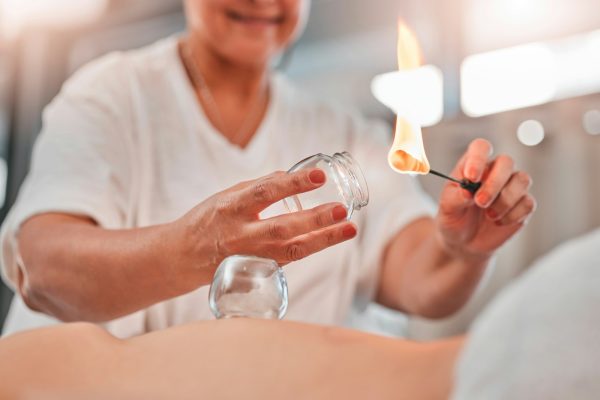 woman-hands-or-flame-for-cupping-therapy-in-spa-hotel-salon-or-holistic-chinese-treatment-for-pai.jpg